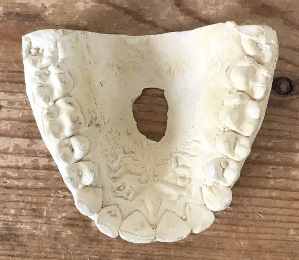 Vintage Dental Oddity Plaster Tooth Top Teeth Mold Dentist Cast Impression